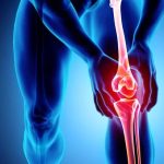 Don’t Ignore the Pain Why You Might Need a Knee Specialist Now