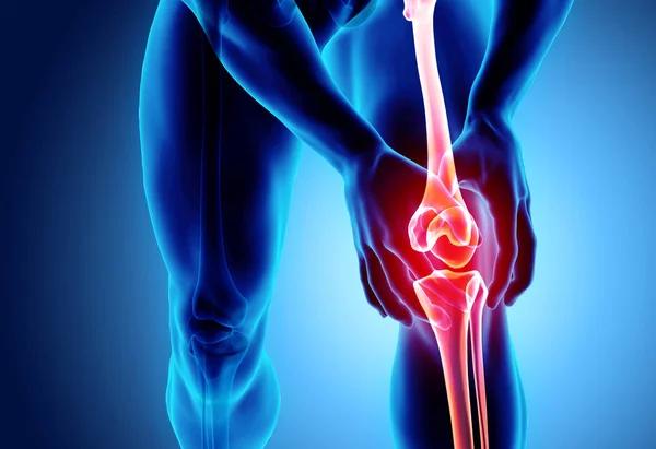 Don’t Ignore the Pain Why You Might Need a Knee Specialist Now